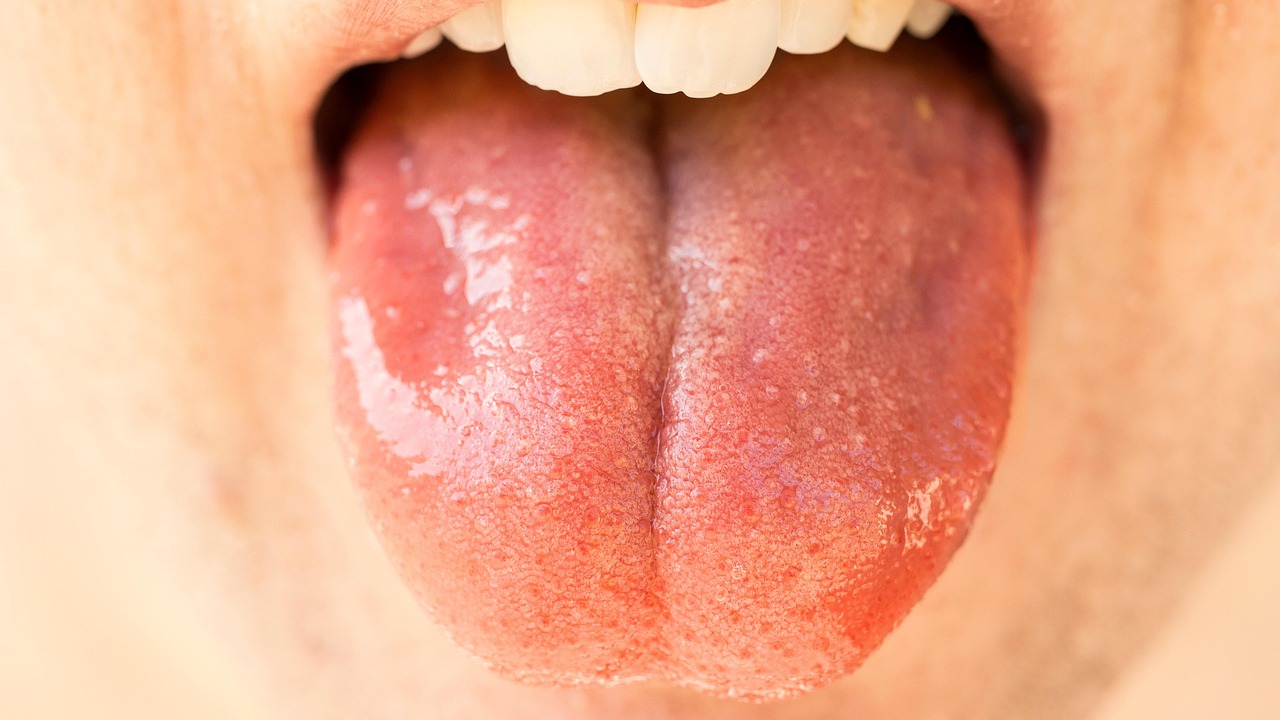 Ce este stomatita: cauze, simptome, transmitere și tratament